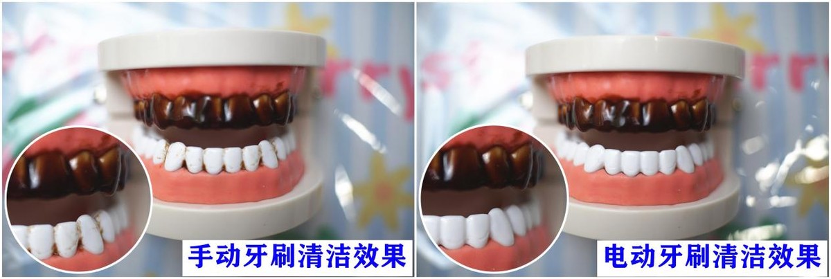 电动牙刷安全吗警惕3大缺陷隐患,电动牙刷的弊端图片