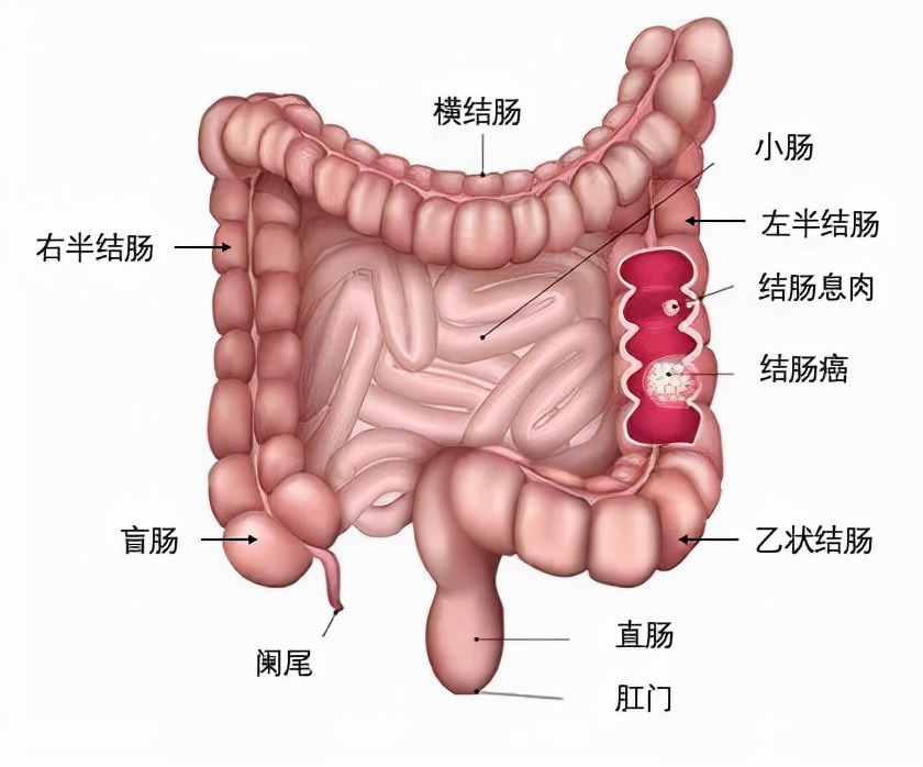 球王贝利几岁查出来癌症,球王贝利重病