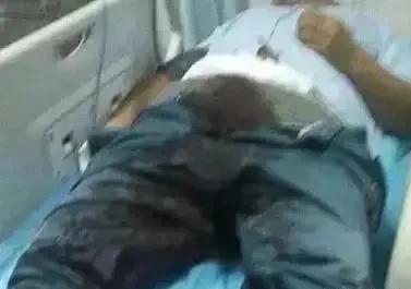 用剪刀切掉生殖器判几年,男子生殖器被剪违法不