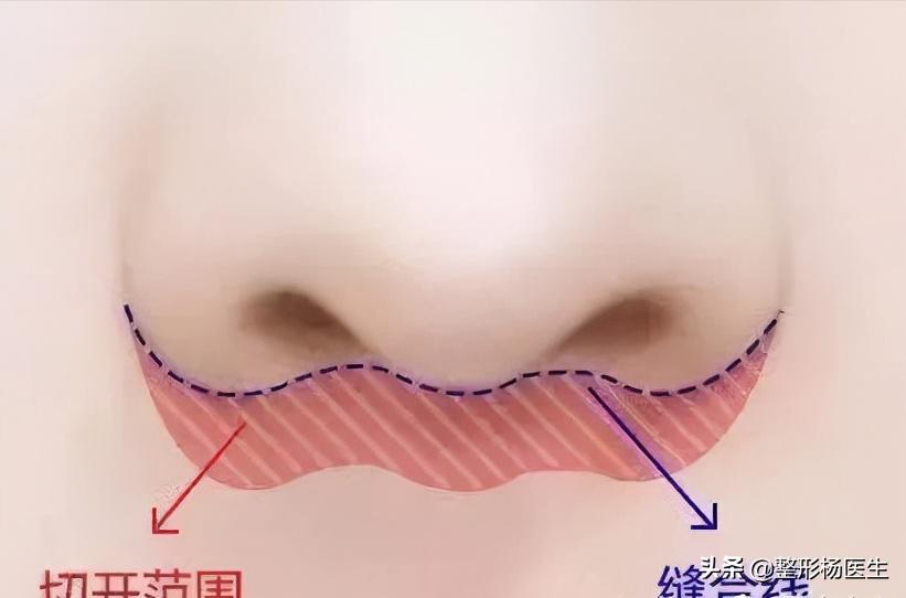 人中太长了好看吗,人中太长显老怎么办