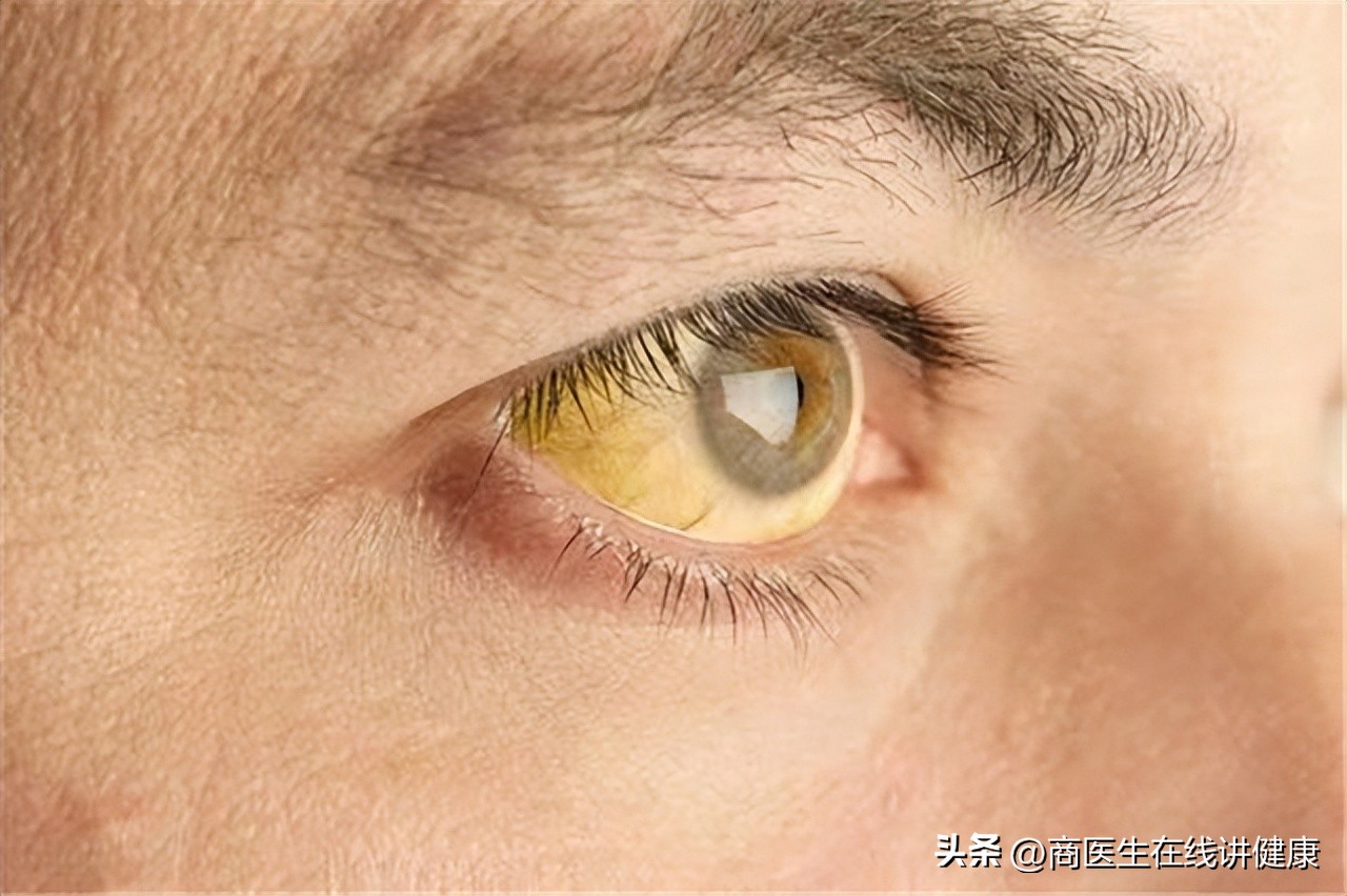 胰腺癌发现就是晚期吗,胰腺癌晚期出现打嗝症状怎么治疗