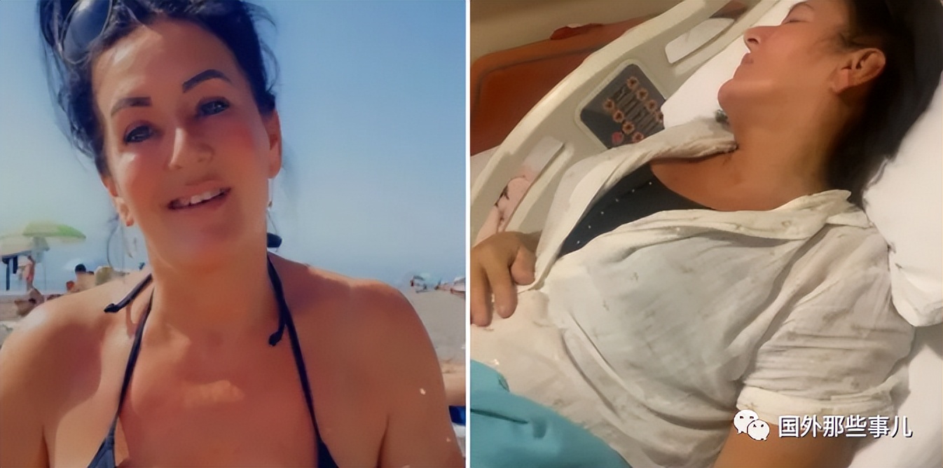 英国女子为了美做隆胸手术，如今胸部却破裂出现2个洞