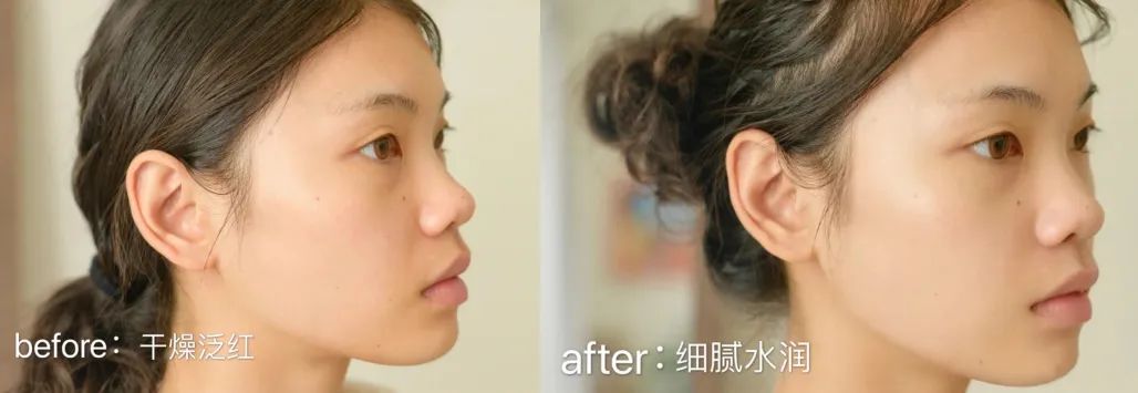 雅诗兰黛第二代粉水适合什么皮肤,雅诗兰黛大粉水适合哪个年龄段