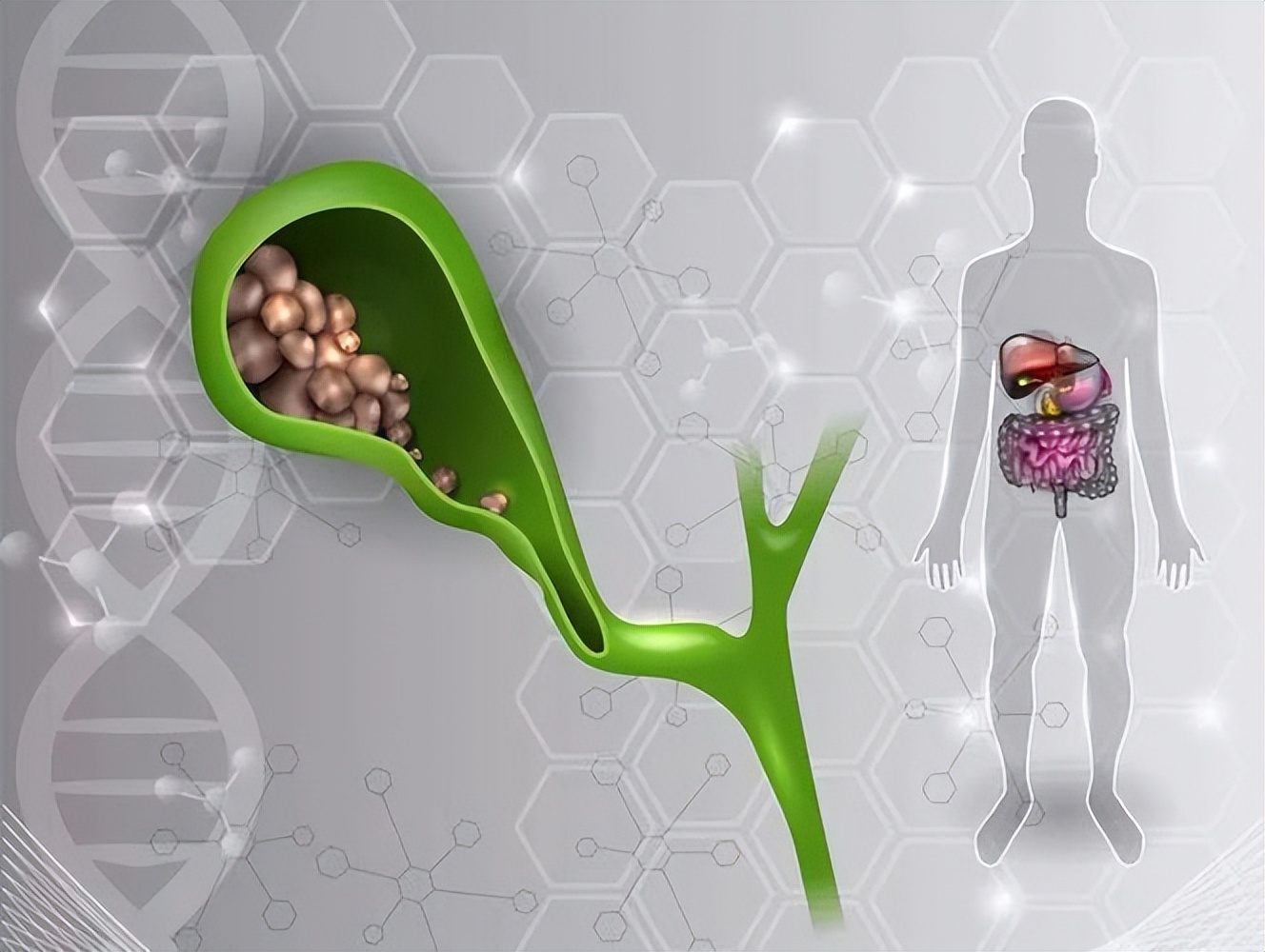 胆囊切除后遗症有哪些,胆囊切除都有哪些后遗症