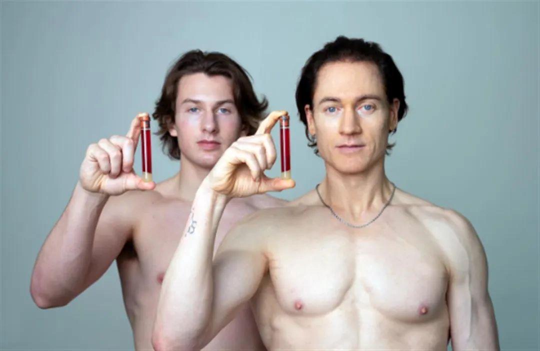 硅谷富豪换血长生不老,长生不老的富豪用自己儿子换血