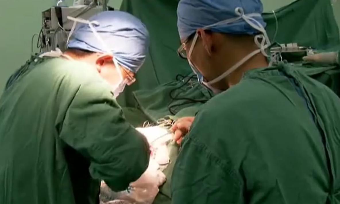 男子身患巨人症身高竟有两米四二,外国夫妇生了巨人症的孩子