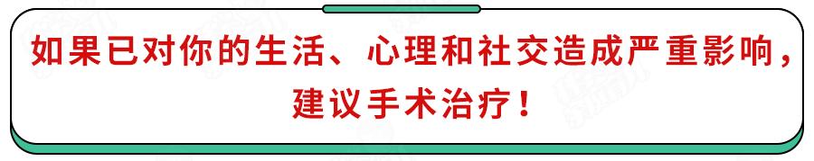 男孩手心总是湿漉漉的,男童手心出汗湿是怎么回事