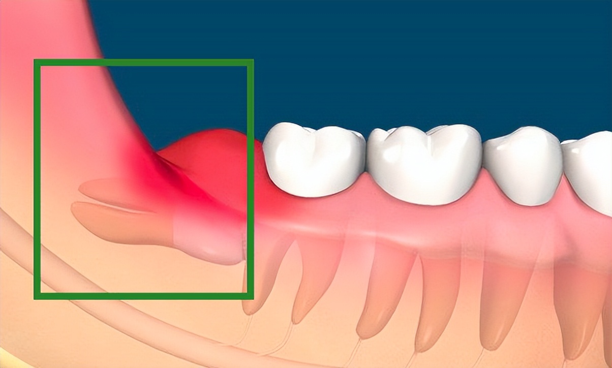 人体这些复杂的器官你知道吗,人体最难伺候的器官