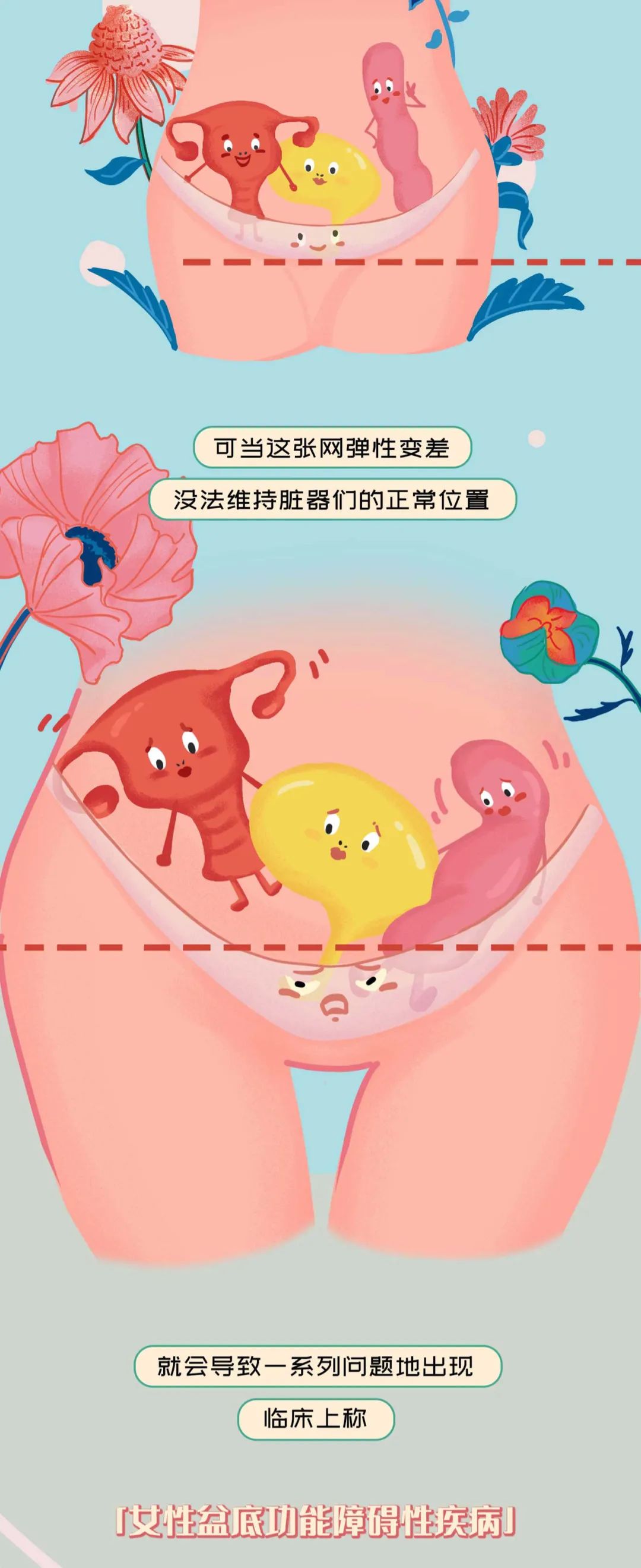 被误解的腘绳肌,被误解妇科疾病有哪些