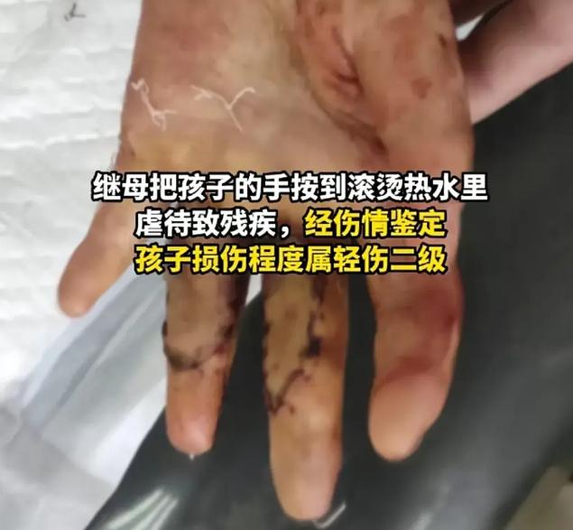 6岁被继母虐待女童事件完整版,六岁女童惨遭继母虐待