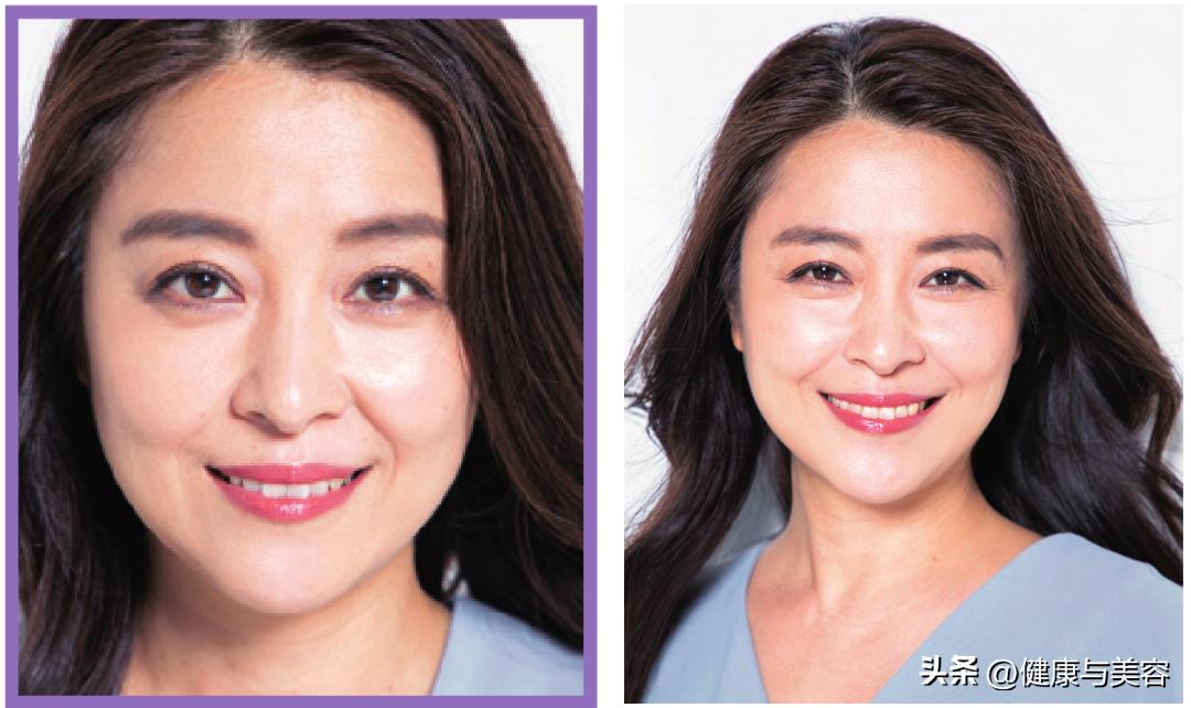 眼部皱纹抗皱,眼部抗衰去皱纹