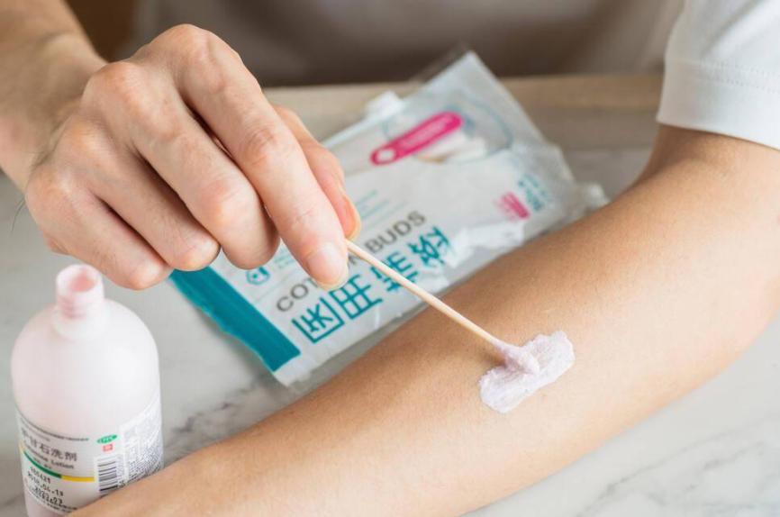 3块钱一瓶的炉甘石洗剂，连世卫组织都推荐，能用它来治哪些病？