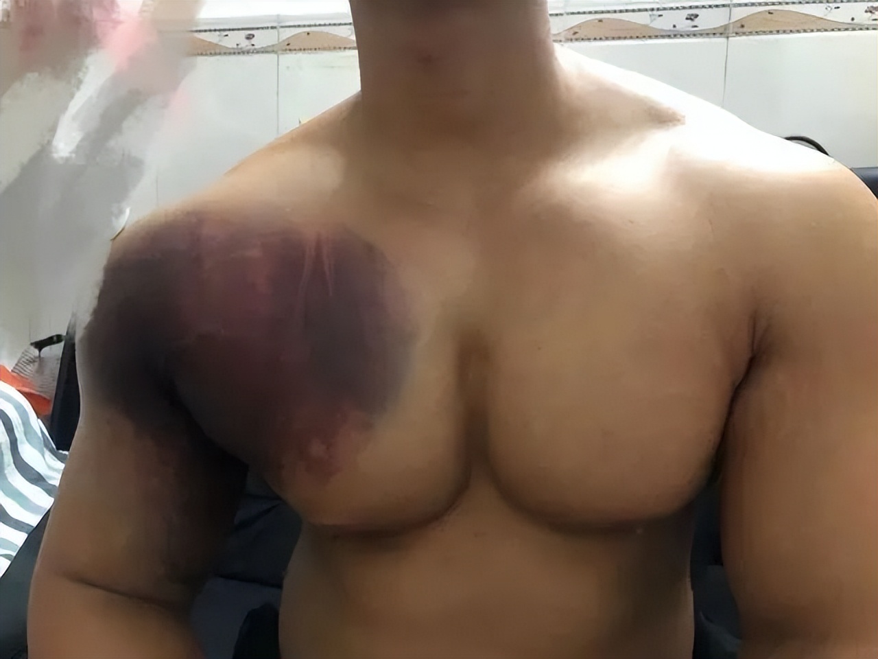 卧推200kg被砸,小伙卧推失误被锁喉过程揪心