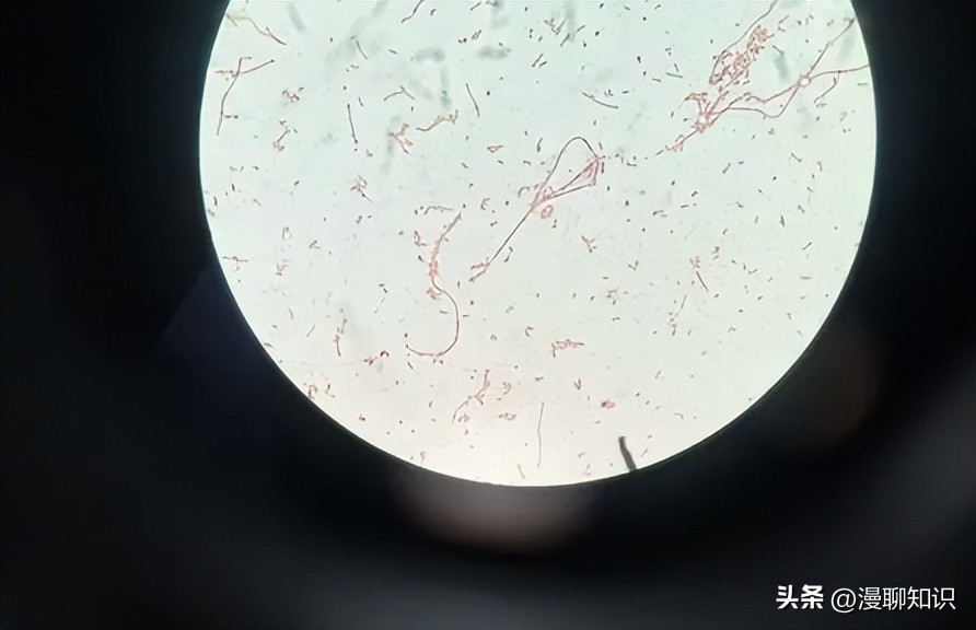 大肠杆菌是什么样,大肠杆菌学名