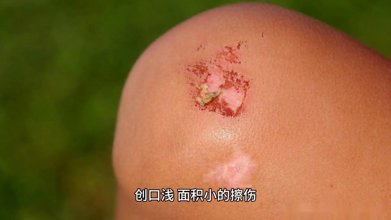 常见运动损伤的预防和紧急处理,运动损伤的预防及处理ppt