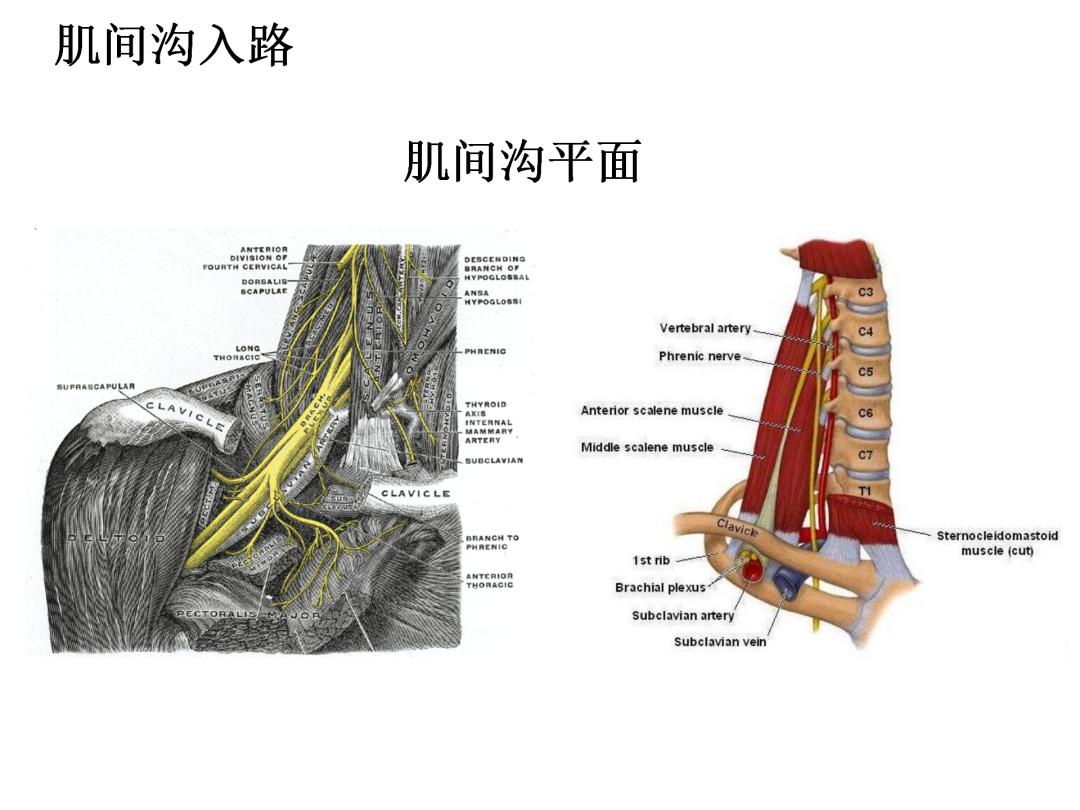 超声引导下臂丛神经阻滞,PPT课件