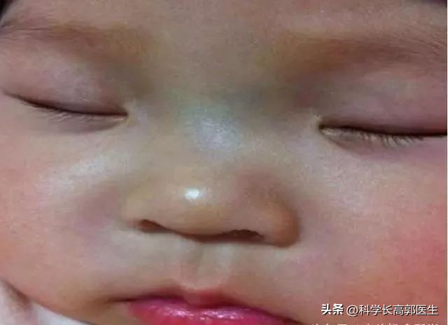 小孩咳嗽反复发烧有什么好方法,孩子咳嗽反复发烧怎么办最有效