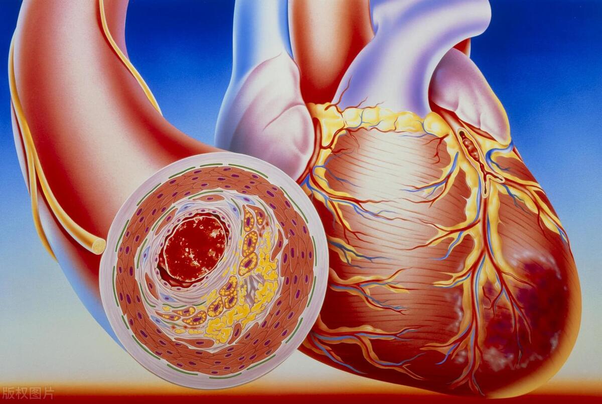 岳母被查出血栓后，妻子要我晚上陪着岳母睡，岳母夜间却心梗离世