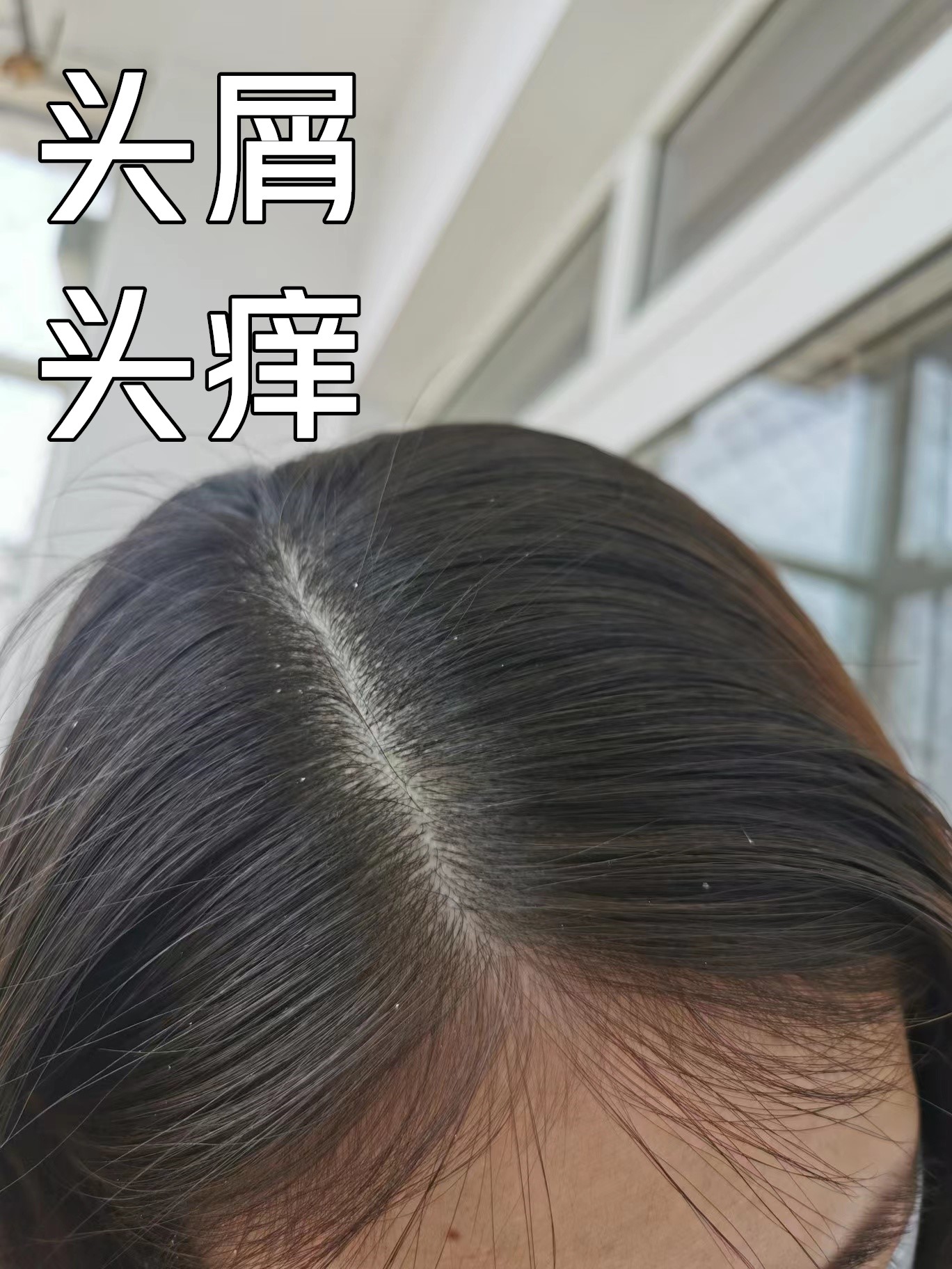 洗发水是飘柔好用还是阿道夫好用,洗发水排名阿道夫