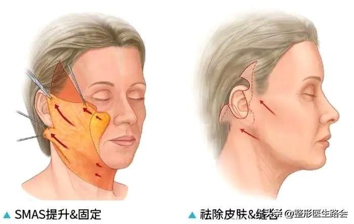 脸干有细纹显老,脸部皮肤黑显老怎么办