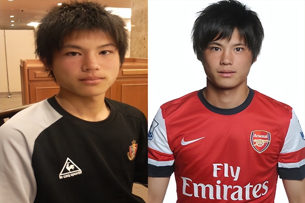 十字韧带三次断裂,三次十字韧带断裂