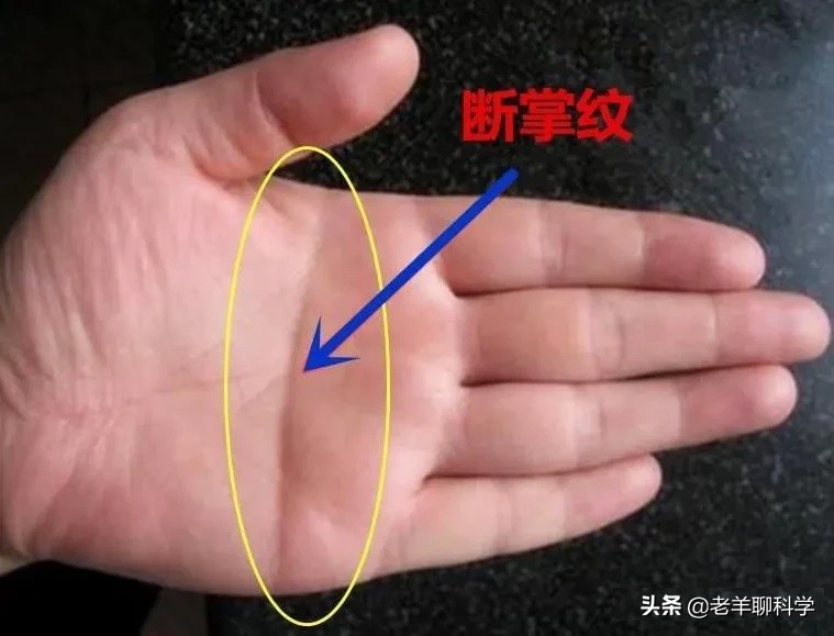 断掌纹有科学依据吗,男子一只手纹断掌好吗