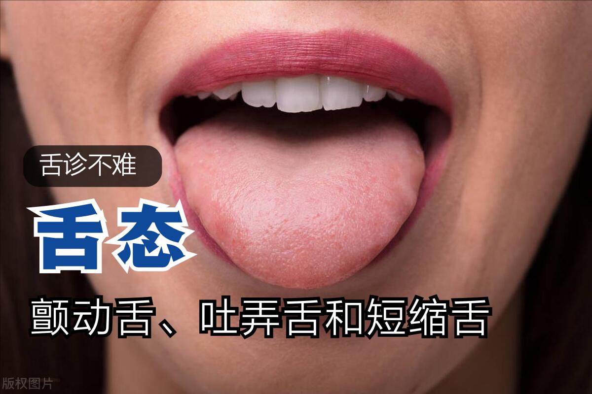 舌诊不难:解读颤动舌、吐弄舌和短缩舌
