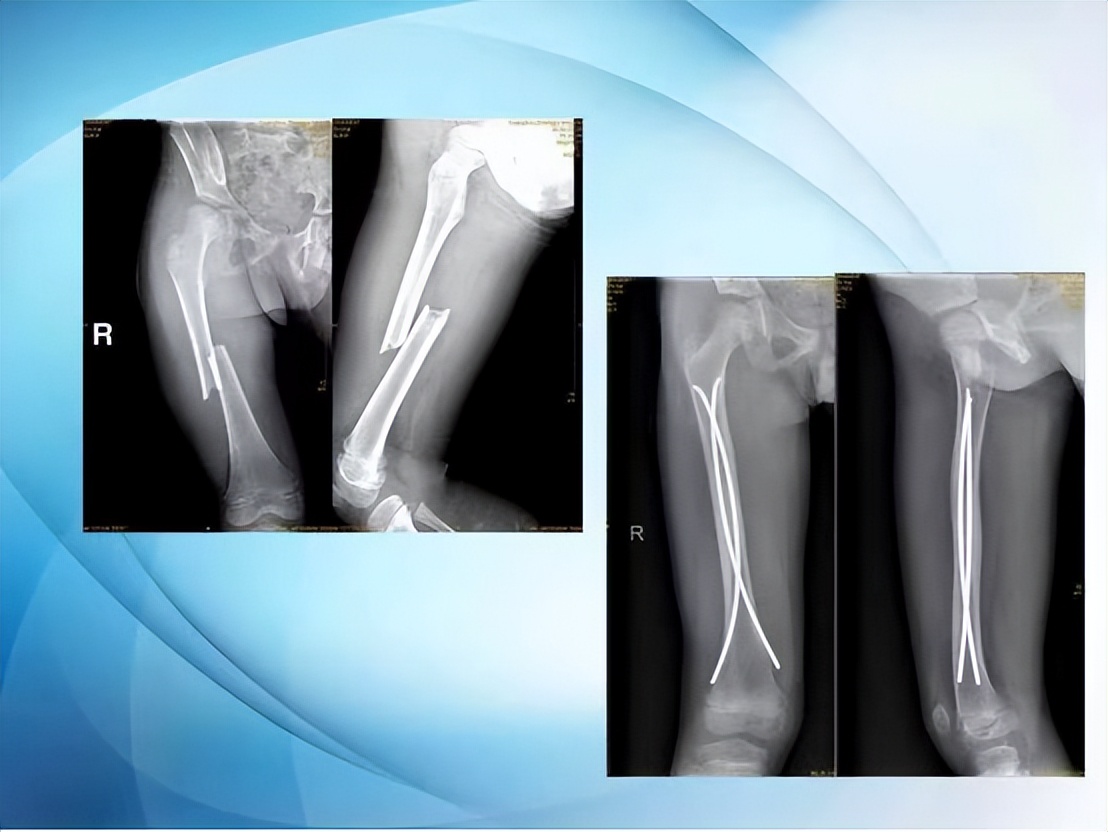 瀹堟姢瀹濆疂楠ㄩ鎴愰暱,瀹堟姢鍎跨鍋ュ悍鍖婚櫌