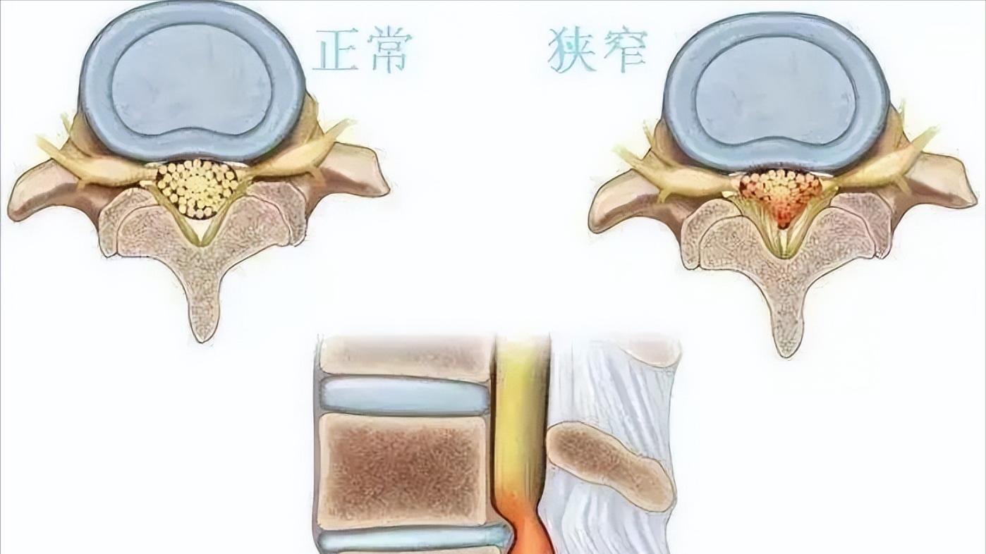 终身无法治愈的十种骨科病,骨科医生的10个忠告记住了