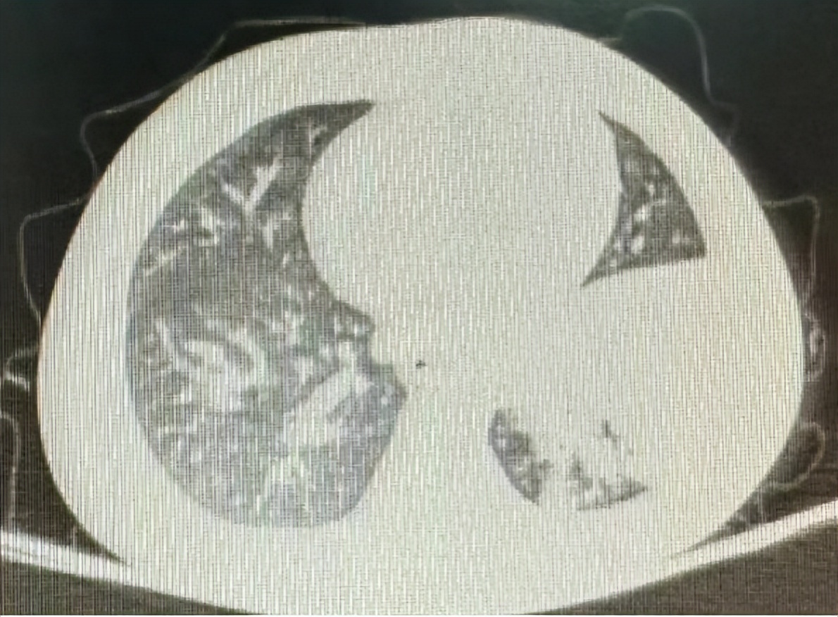 小孩咳嗽发烧前面高热后面低热,孩子反复高热咳嗽是什么原因