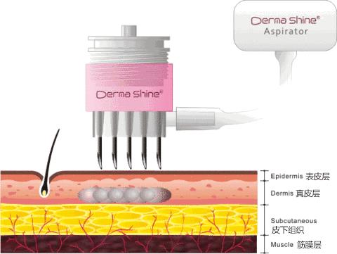 面部暗沉无光泽显老怎么改善,皮肤暗沉皱纹显老