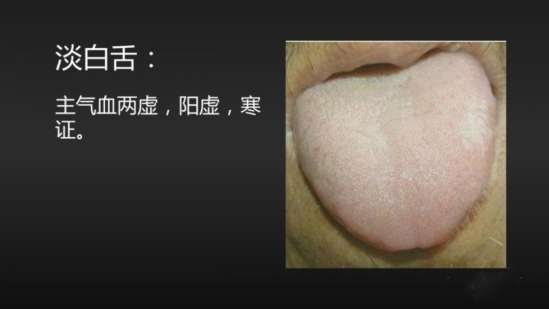 舌诊辨证和精准用药,中医诊病无需诊脉和观舌象靠谱不