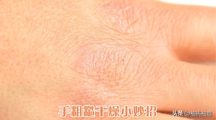 不要钱的生活小妙招,不花钱的王炸生活小妙招