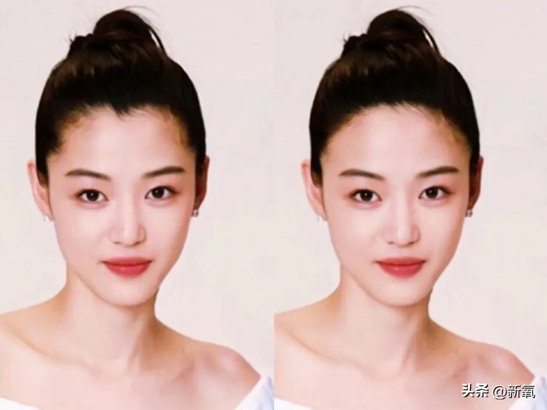 高颅顶怎么掩饰发际线,高颅顶会显得发际线低吗