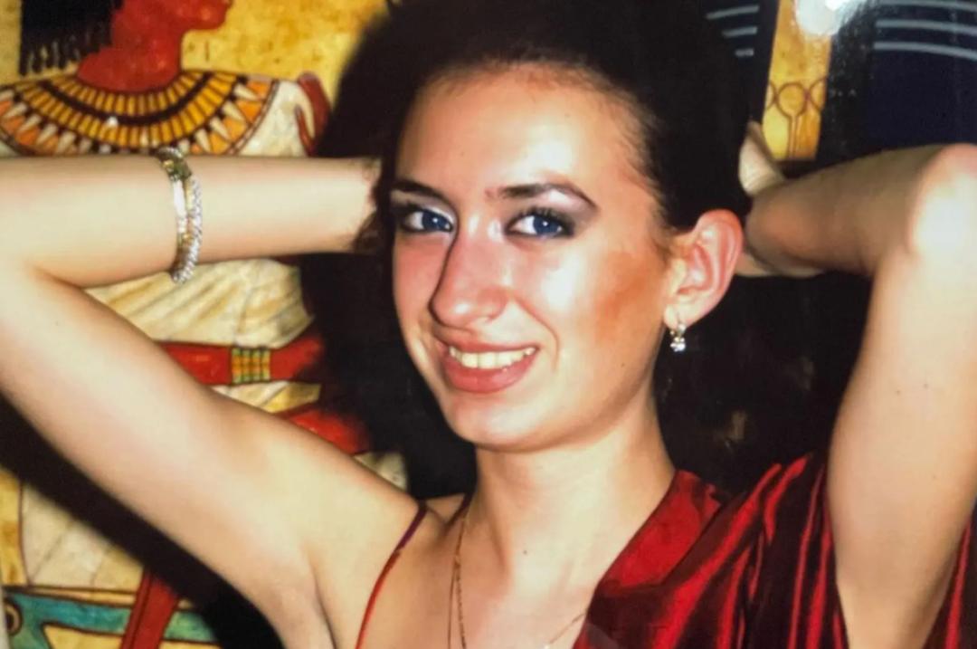 这个动手术打造世界最高颧骨的女人，再次向自己的颧骨下手了