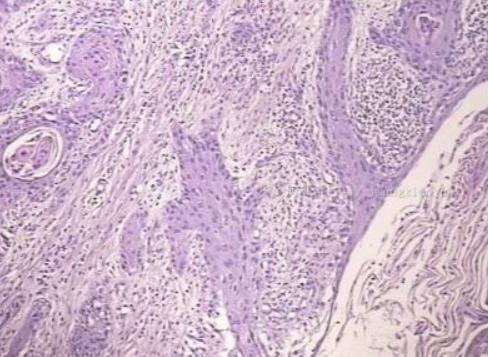 私部瘙痒疼痛是什么原因,私部疼痛瘙痒是什么原因