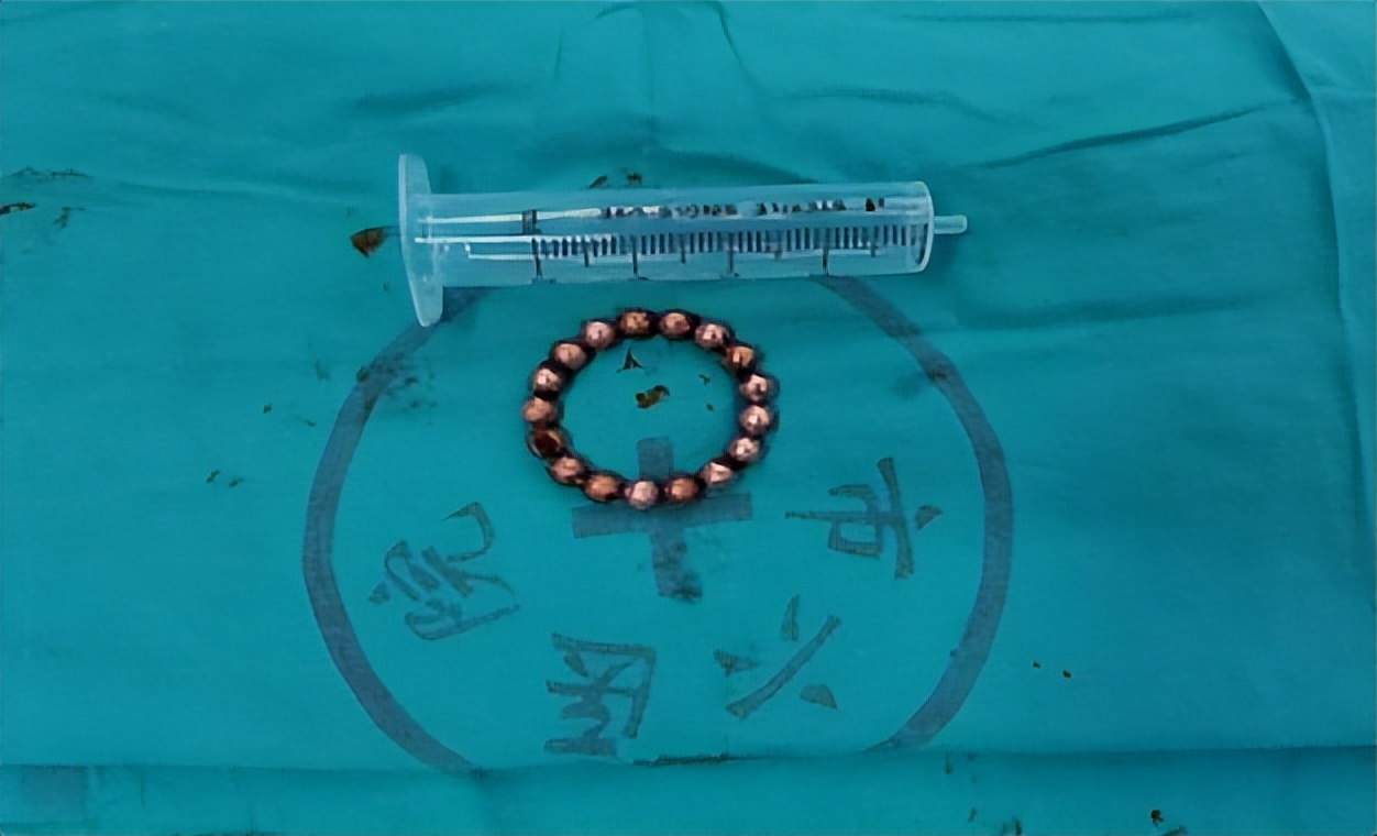 尿道异物怎么消除,如果尿道有异物应该怎么办