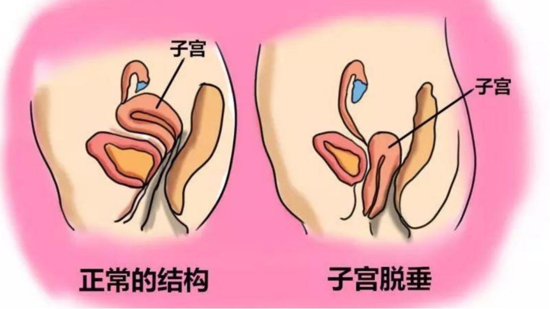 注意性缺陷多动障碍临床表现,注意功能障碍属于什么障碍