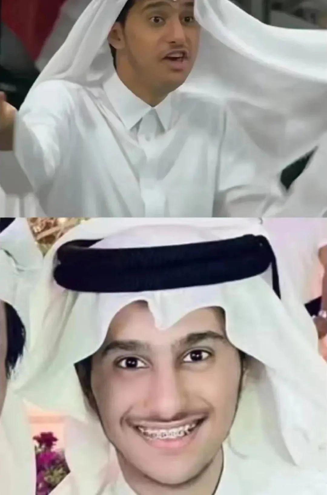 c罗是怎么整牙的,c罗的牙齿整过形吗