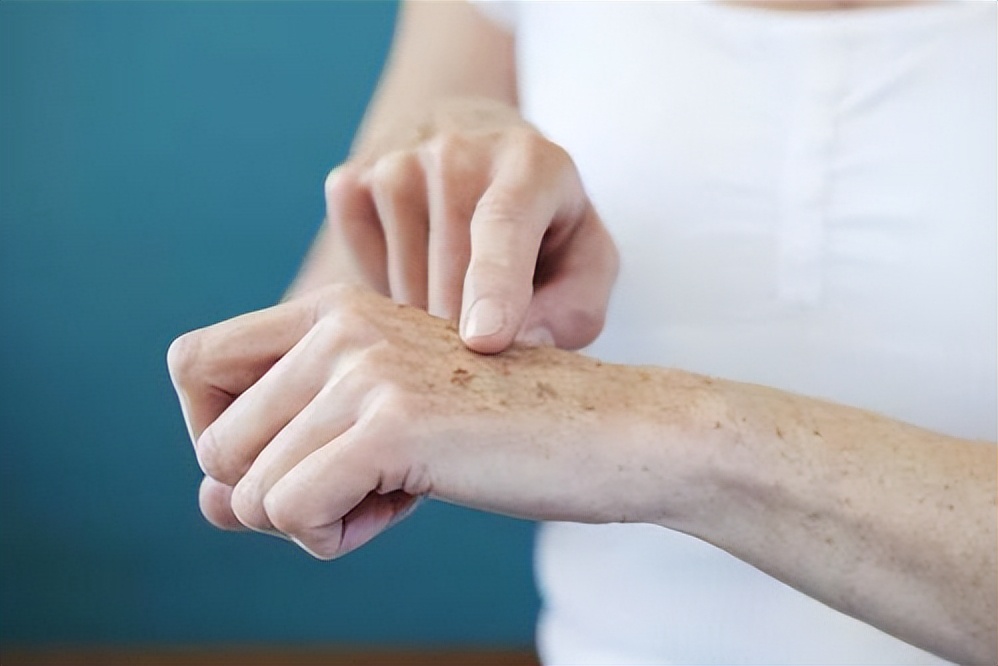 老年斑为什么会越来越大颜色变深,年轻长老年斑的原因以及解决方案