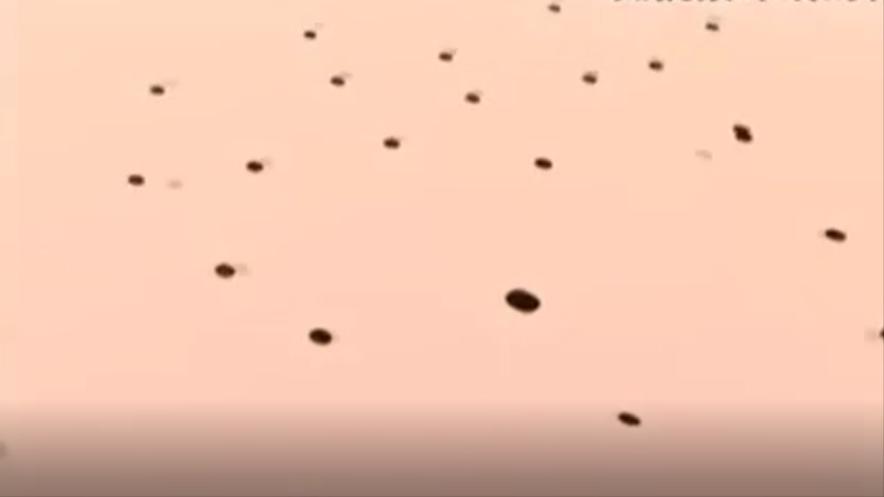 割皮救子父亲康复情况,儿子刚出生为弟弟捐骨髓后续