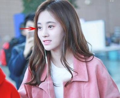 塌鼻子变美思路看这里,塌鼻梁怎么变漂亮