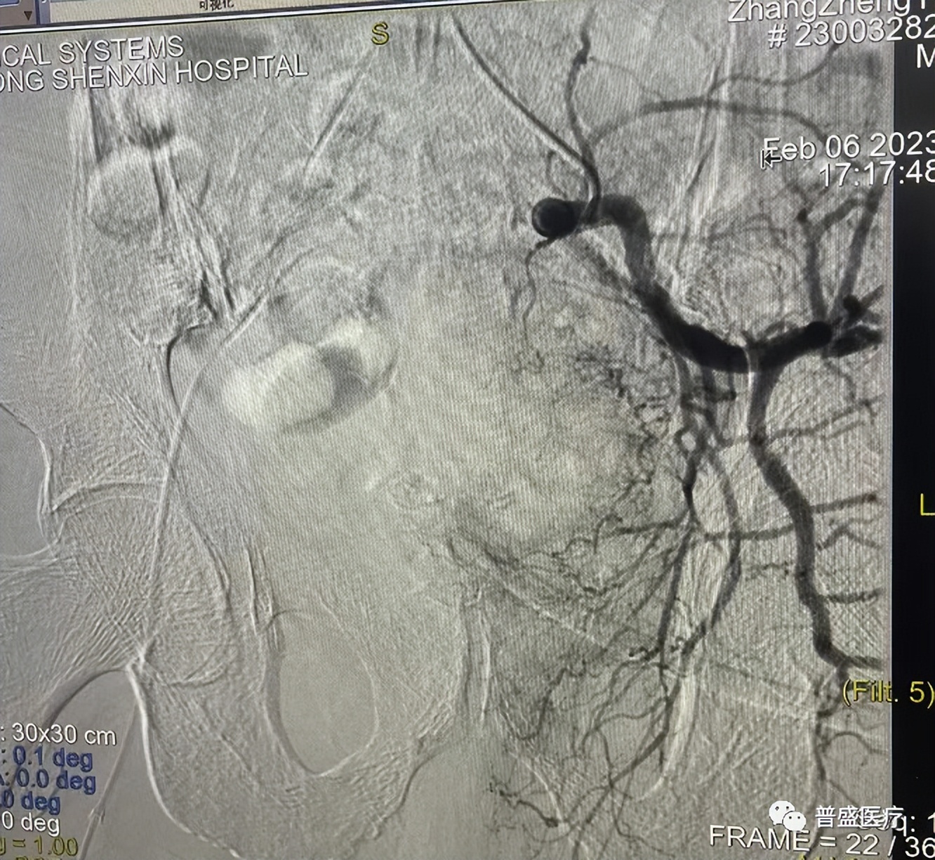 南充治肿瘤最好的医院,南充哪家医院治肿瘤好