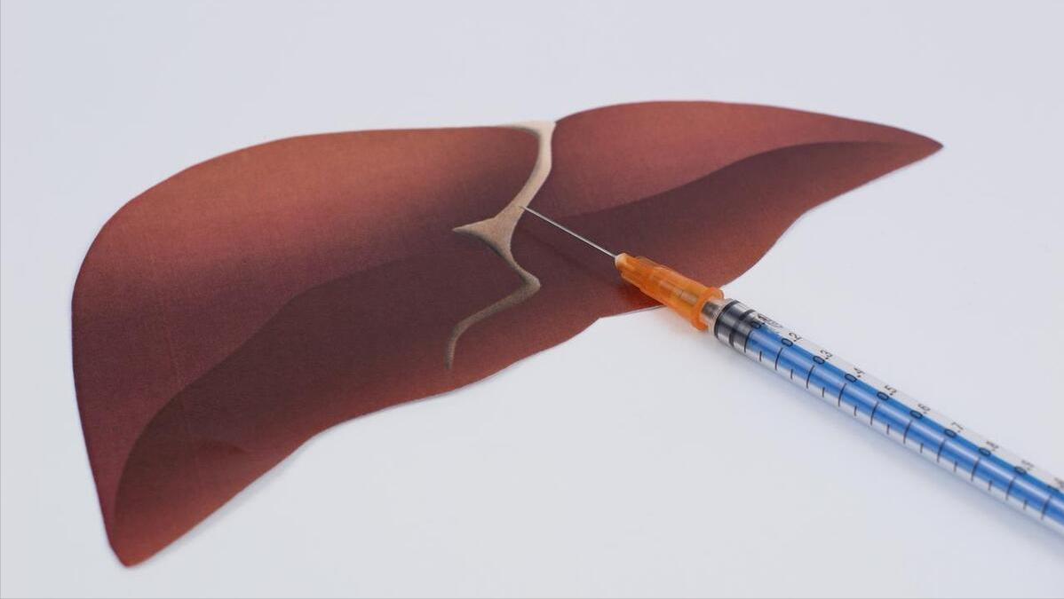 谷丙转氨酶和谷草转氨酶高好治吗,谷丙转氨酶高和谷草转氨酶的区别