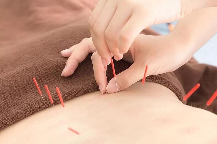 中医针灸治疗颈椎病原理,颈椎病针刀按摩针灸哪种方法好