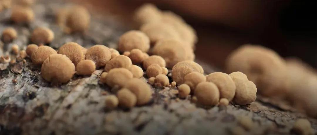 子宫里长了一堆肉球？一直漫不经心的我被吓懵