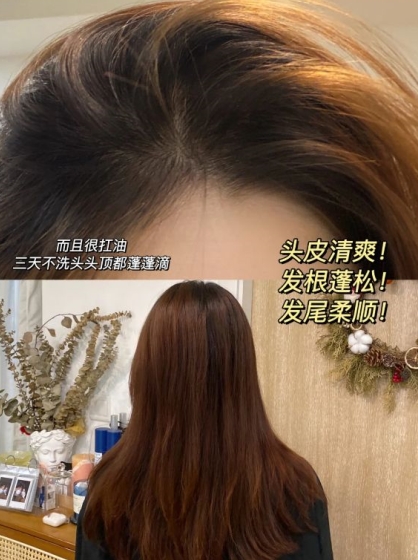 孕妇控油止痒去屑洗发水推荐,控油好的孕妇洗发水品牌