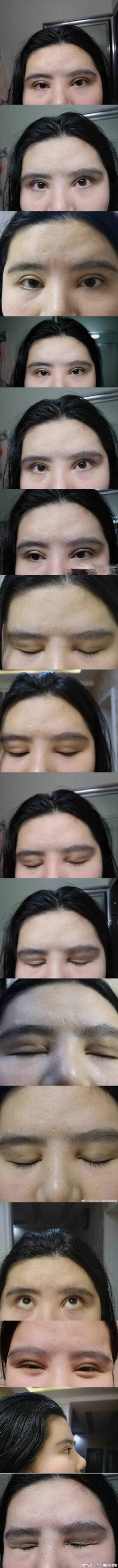 千万别被网红宽双眼皮*脑洗**了，对眉骨高眼窝深邃的人可能是灾难