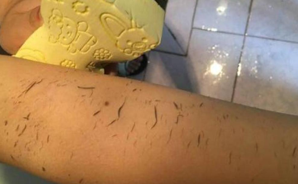 洗澡搓下来的黑泥显微镜放大100倍,洗澡搓下的黑泥用显微镜放大