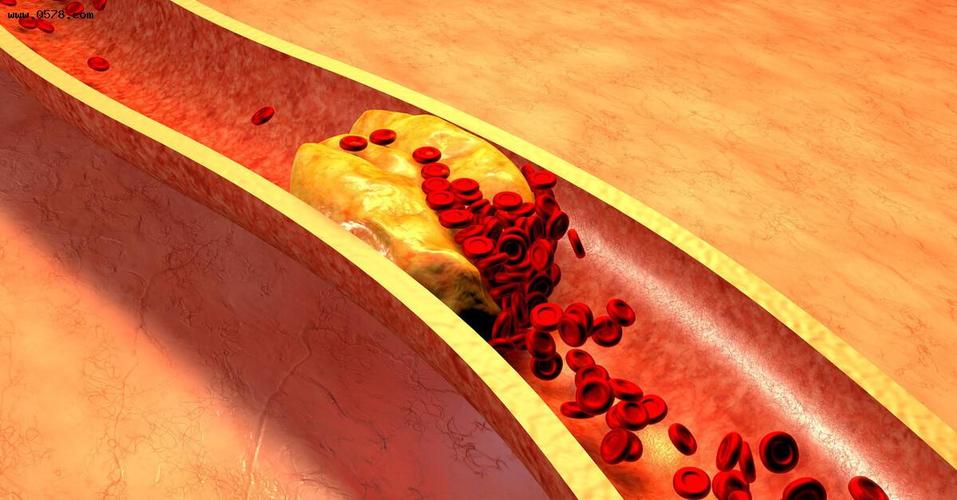 血液粘稠怎么调理好？医生提醒：做好这4件事，有助于血液畅通